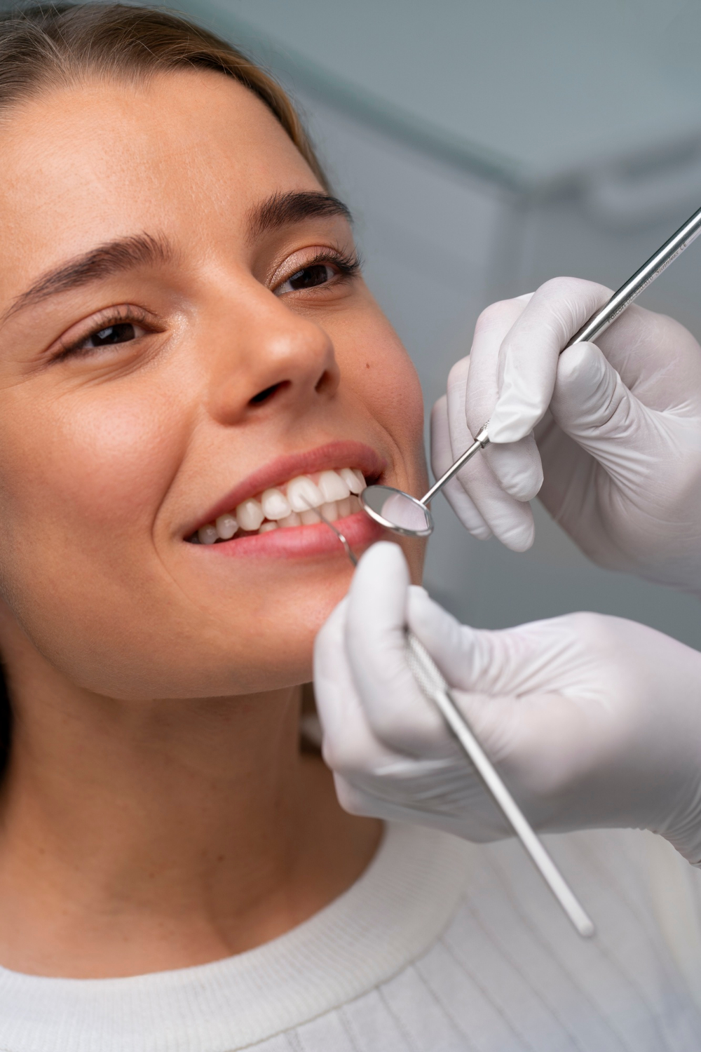 Facetas Dentárias